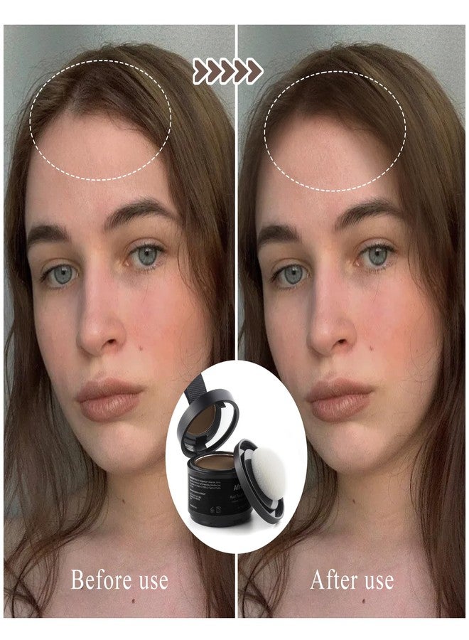 afmicat Instant Hairline Powder, Root Touch Up Hair Color for Gray Coverage and Thinning Hair, Root Cover Up Conceals Hair Loss & Bald Spots, Natural and Non-Greasy Hair Color for Women & Men, Medium-Brown - Image 2